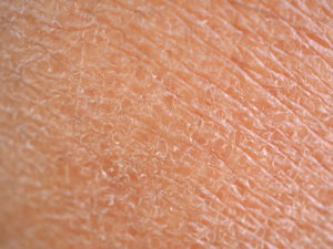 closeup on an area of rough dry skin