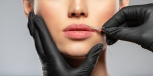 woman receiving botox injection on upper lip