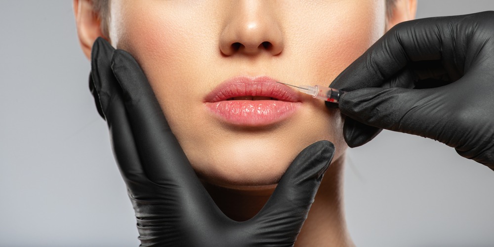 Close-up of a woman receiving a lip filler injection by a professional wearing black gloves, highlighting aesthetic beauty treatments and cosmetic procedures.