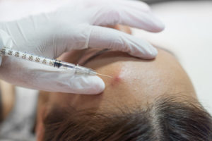 Banish Keloid Scarring (And More): How Cortisone Injections Can Transform Your Appearance