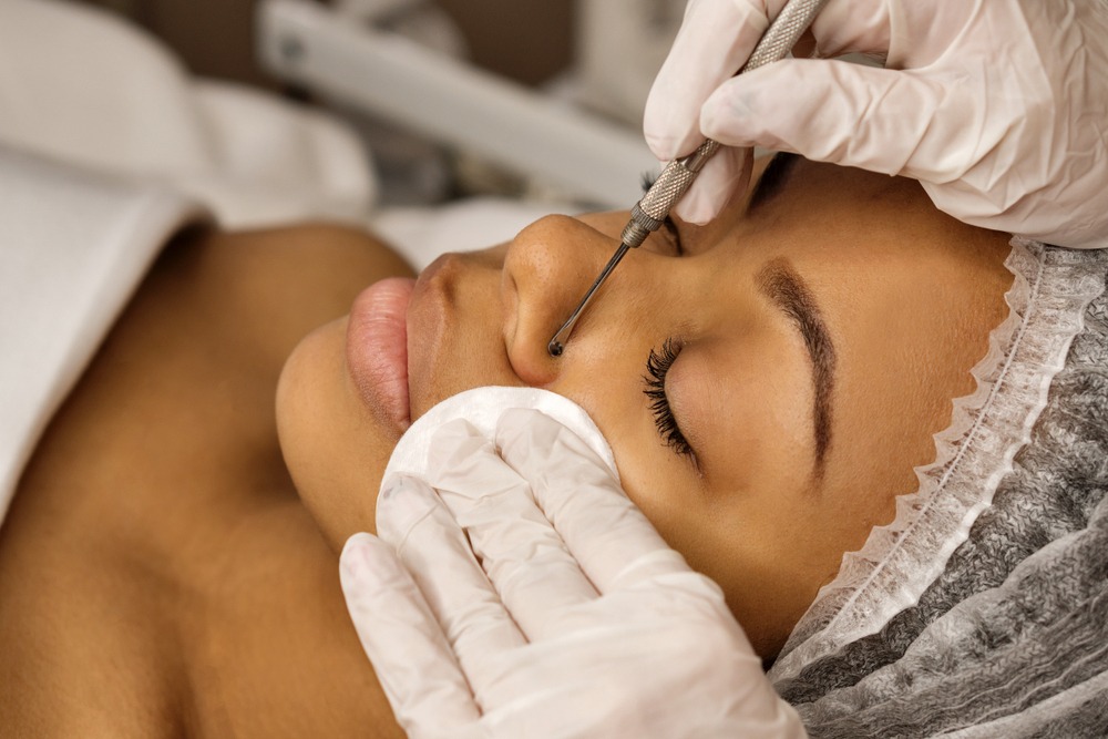 Aesthetic treatment session in a spa, featuring a beautician performing a facial procedure on a client. The client lies comfortably with a cotton pad on her face, while the professional gently uses a tool to enhance skin clarity and texture.