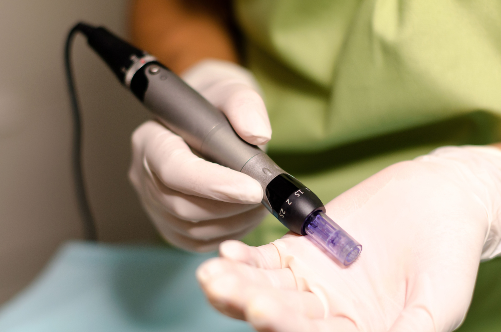 Microneedling pen held in a gloved hand, showcasing the device's needle cartridge, commonly used for skin rejuvenation and collagen stimulation in aesthetic treatments.
