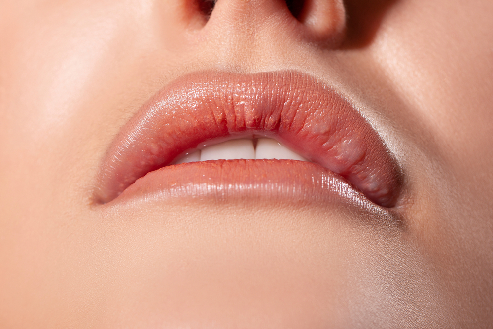 Cómo evitar que el relleno labial se desplace