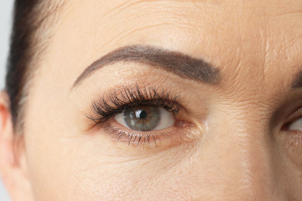 How a Botox Brow Lift Can Change Your Face
